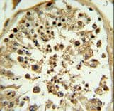 APOL4 / Apolipoprotein L 4 Antibody (aa258-290)