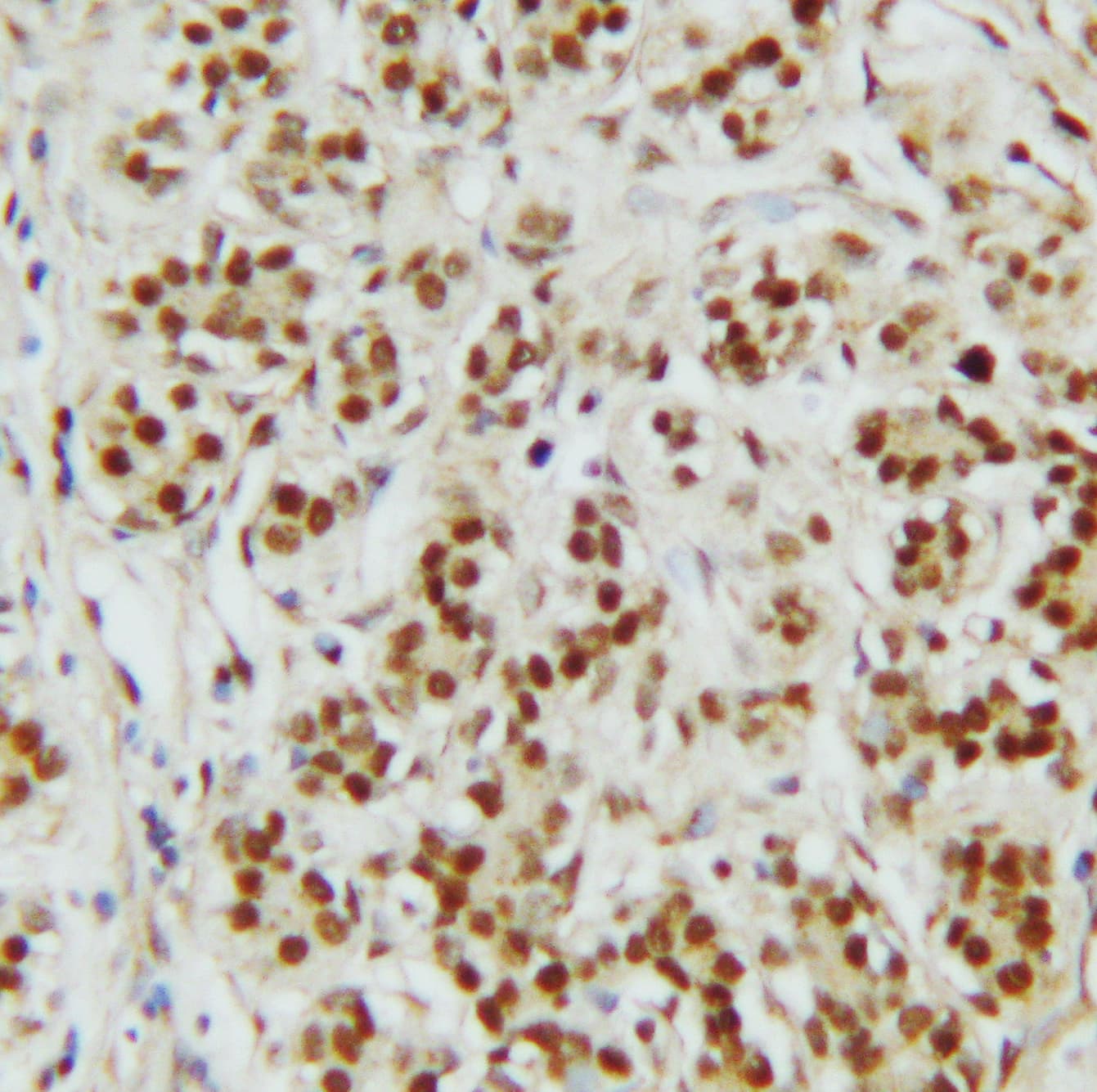 Polyclonal Rabbit anti-Human CTBP2 Antibody (aa429-445, IHC, WB)