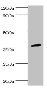 CD200R1 / CD200R Antibody (aa226-325)