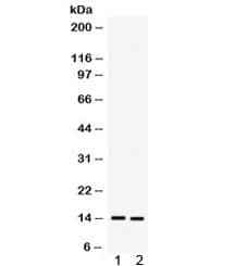 Polyclonal Rabbit anti-Human S100A9 / MRP14 Antibody (IHC, WB)