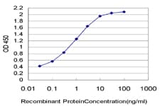 TSPAN20 / UPK1B Antibody (clone 1E1)