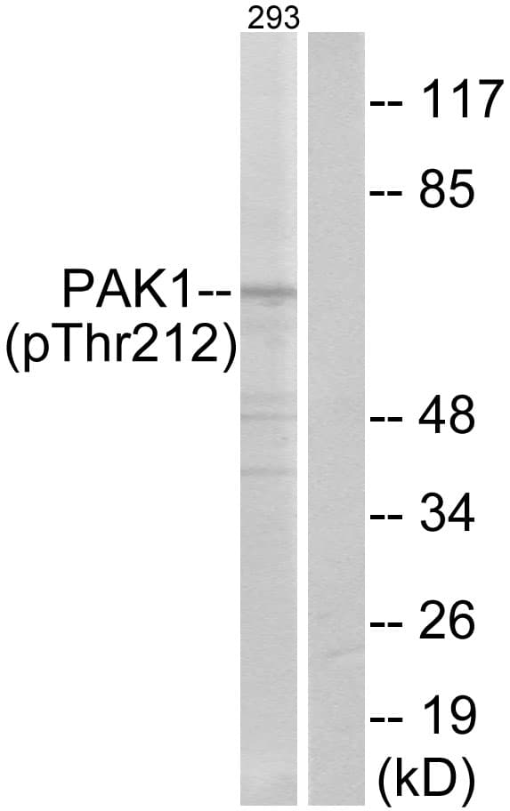 PAK1 Antibody (phospho-Thr212)
