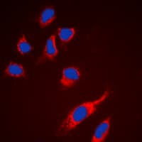 RPS6 / Ribosomal Protein S6 Antibody (C-Terminus)