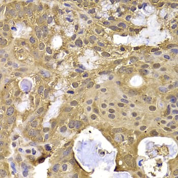 Polyclonal Rabbit anti-Human NAT5 / NAA20 Antibody (IHC, IF, WB)