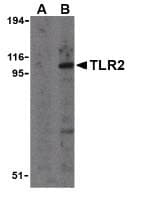 IHC-plus™ TLR2 Antibody