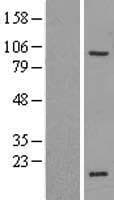 ZNF606 Protein (Over-Expression Lysate Myc-DDK (Flag))