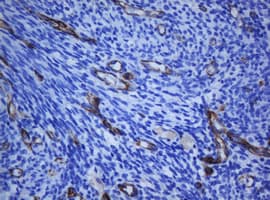 PECAM-1 / CD31 Antibody (clone OTI1F9)