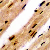 Polyclonal Rabbit anti-Human PSMB8 / LMP7 Antibody (IHC, IF, WB)