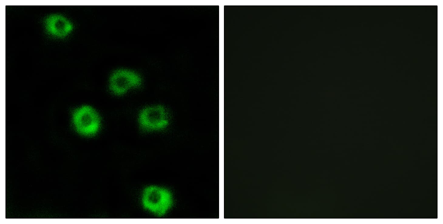 IHC-plus™ ADGRL2 / LPHN2 Antibody (aa551-600)