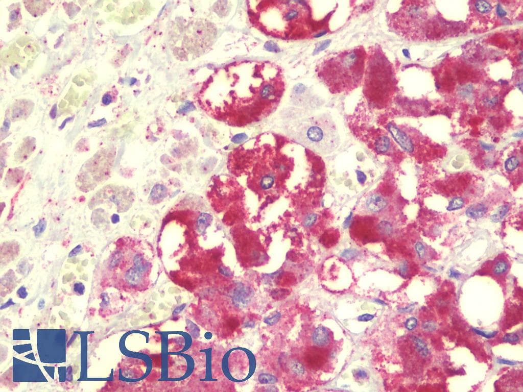 IHC-plus™ Polyclonal Rabbit anti-Human SPTLC2 / LCB2 Antibody (IHC, IF, WB)