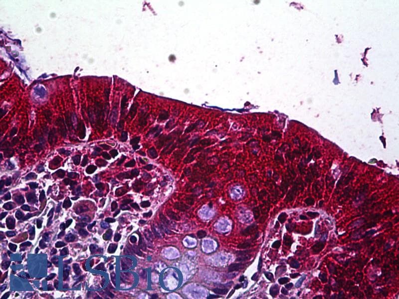 IHC-plus™ Polyclonal Goat anti-Human LRP4 Antibody (aa1765-1777, IHC, WB)