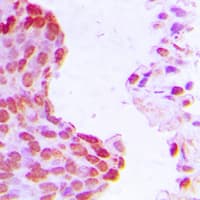 ARNT / HIF-1-Beta Antibody (N-Terminus)