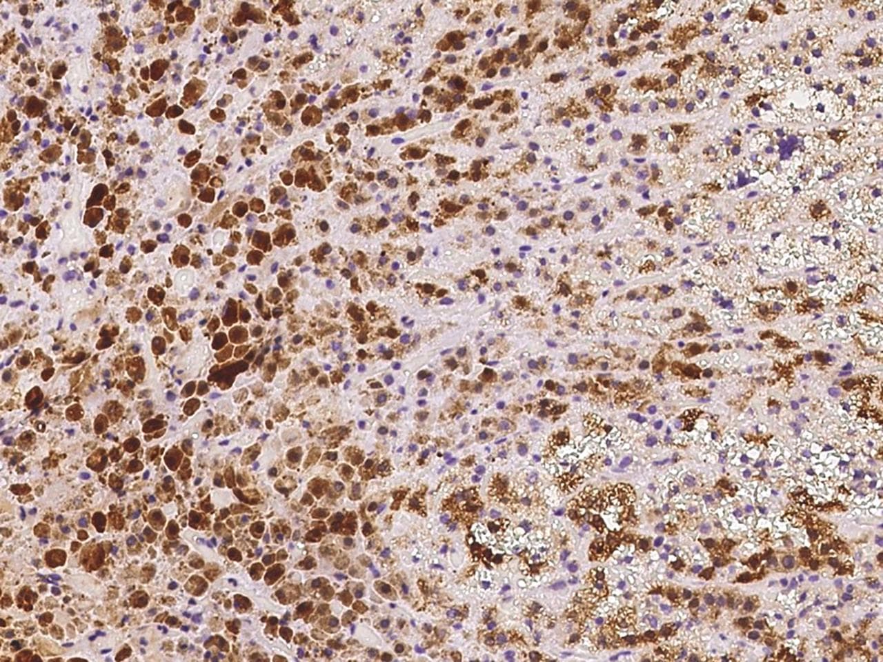 CALB2 / Calretinin Antibody