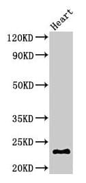 Polyclonal Rabbit anti-Human CRYBA4 Antibody (WB)