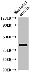 ABO Glycosyltransferase Antibody