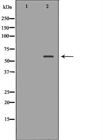 HEXA Antibody