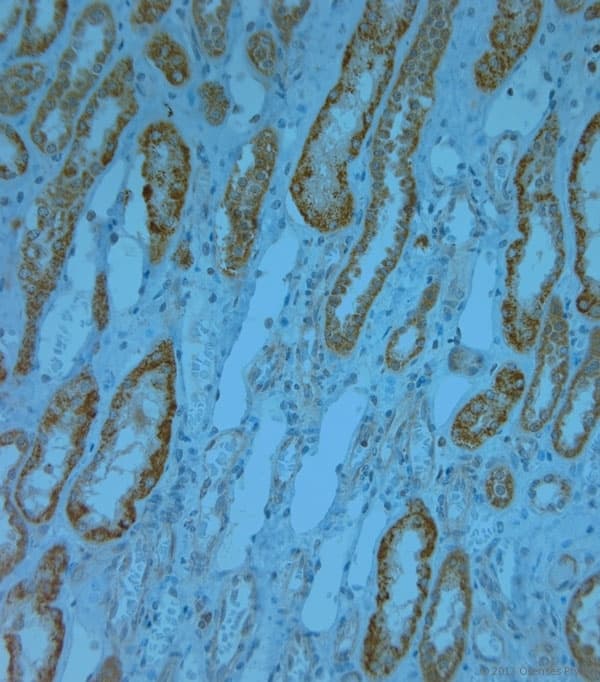 KCNJ13 / KIR7.1 Antibody (aa2-50)
