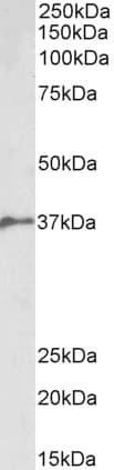 IHC-plus™ Polyclonal Goat anti-Human BMI1 / PCGF4 Antibody (aa237-251, IHC, WB)