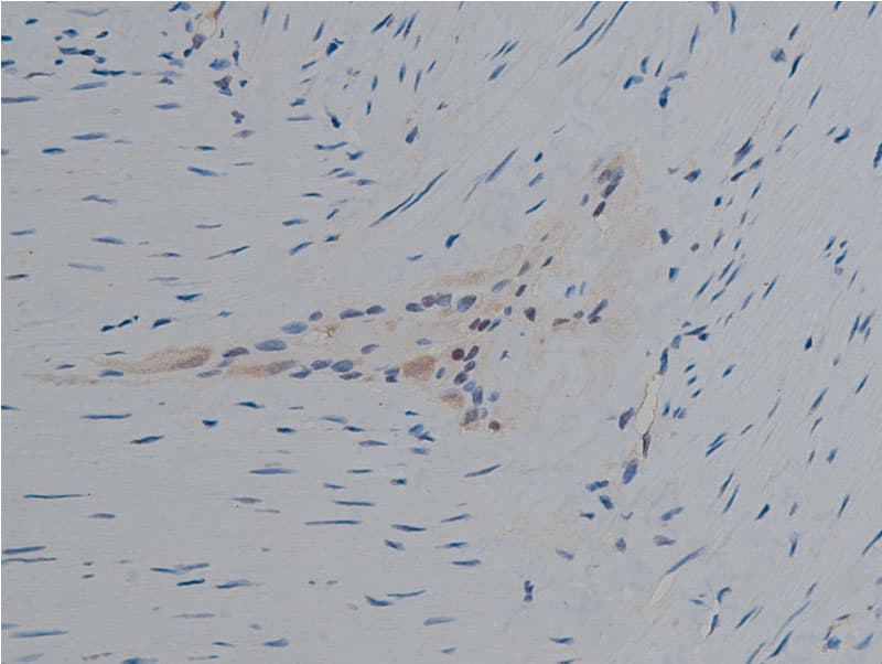 Polyclonal Rabbit anti-Human PLCG1 Antibody (phospho-Tyr771, IHC, IF, WB)