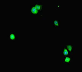Polyclonal Rabbit anti-Human STAT2 Antibody (IHC, IF)