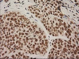 LOX / Lysyl Oxidase Antibody (clone OTI10D11)