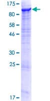 Human ECE-1 Protein (Recombinant GST)
