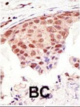 SUMO1 / SMT3 Antibody (aa55-86)