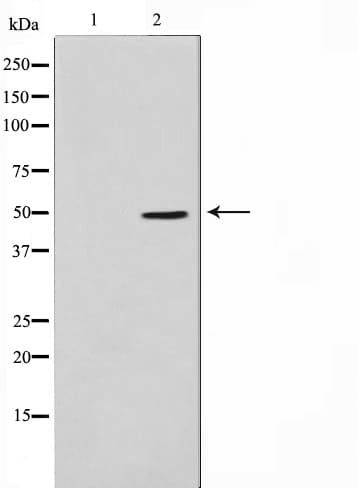 TNFRSF1B / TNFR2 Antibody