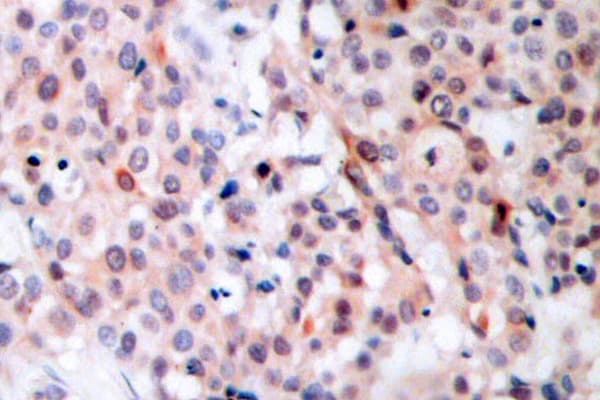 BCL2 / Bcl-2 Antibody (phospho-Thr56)