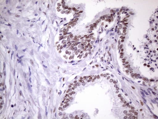 NUDT21 Antibody (aa2-227, clone OTI13H1)