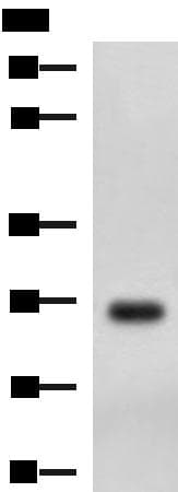 DHRS2 / HEP27 Antibody