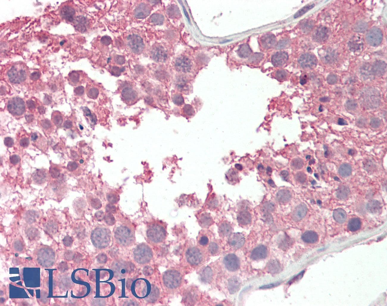 IHC-plus™ RCBTB2 Antibody (aa421-434)