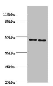 Polyclonal Rabbit anti-Human SERPINH1 / HSP47 Antibody (aa139-418, IHC, WB)