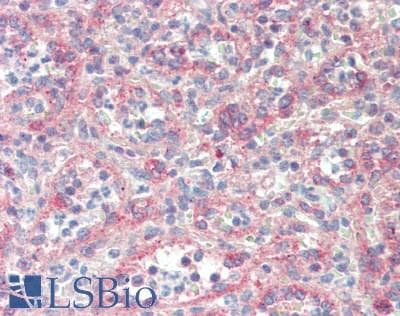 PathPlus™ ROS1 / ROS Antibody (aa1744-1777)