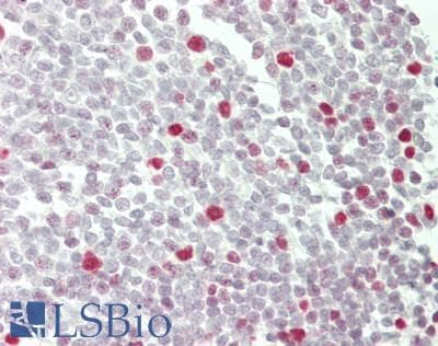 IHC-plus™ ZNF335 / NIF1 Antibody (aa1300-C-term)