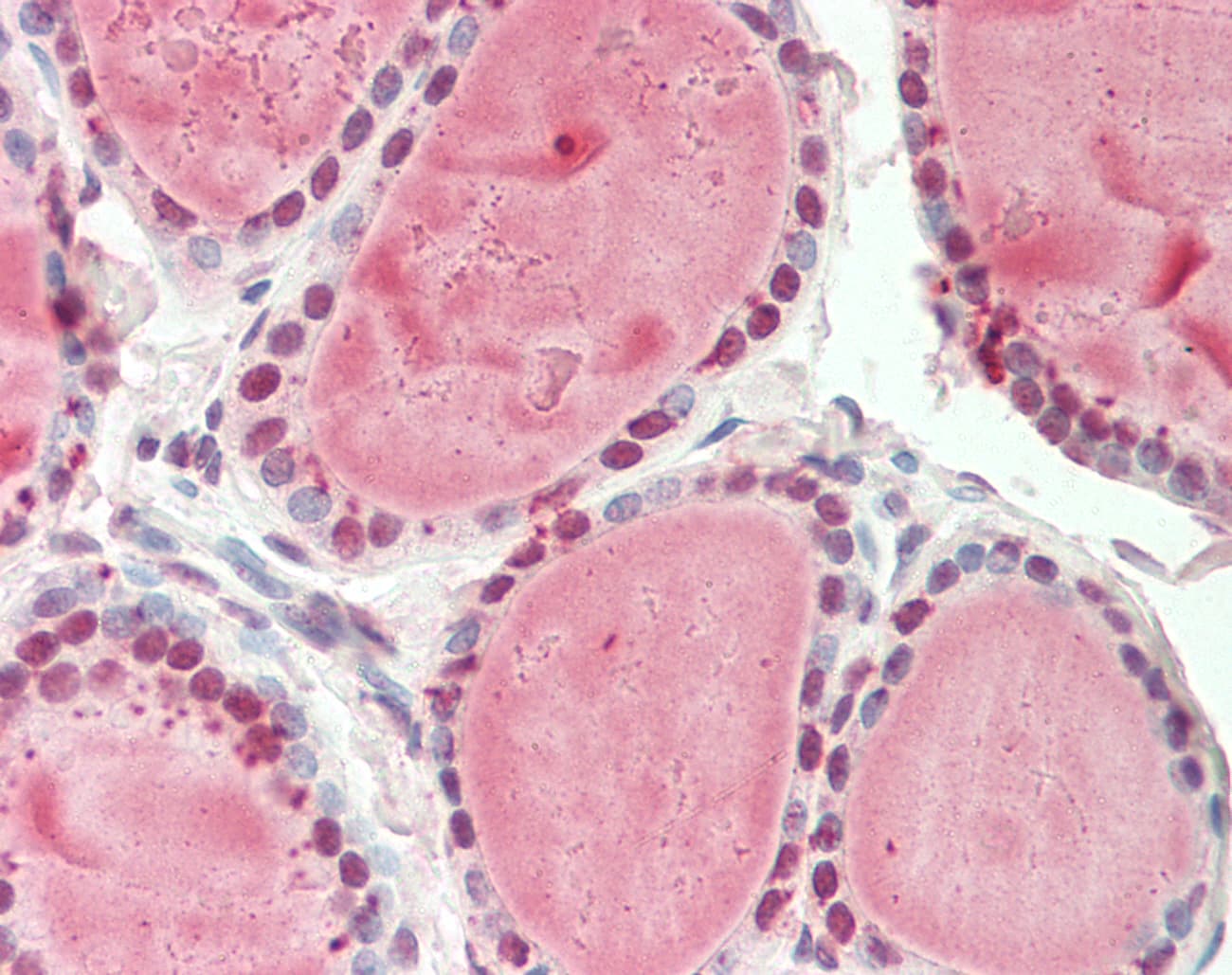 Polyclonal Rabbit anti-Human Nor-1 / NR4A3 Antibody (aa351-400, IHC, WB)
