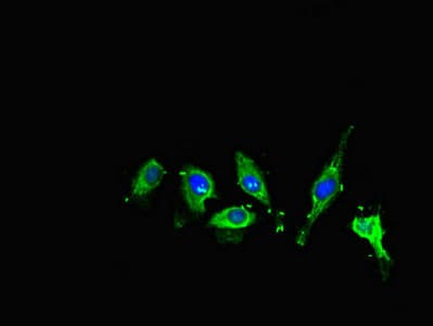 ME1 / Malate Dehydrogenase Antibody