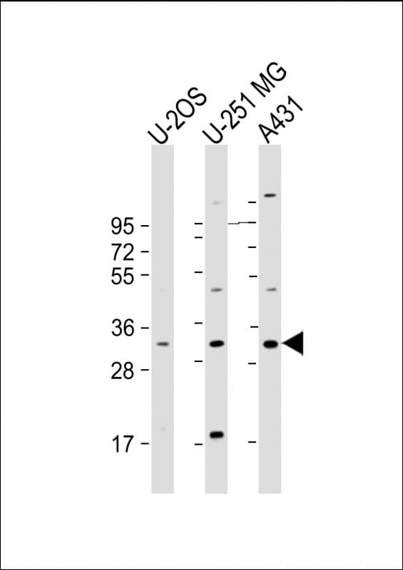 FAM125A Antibody (Internal)