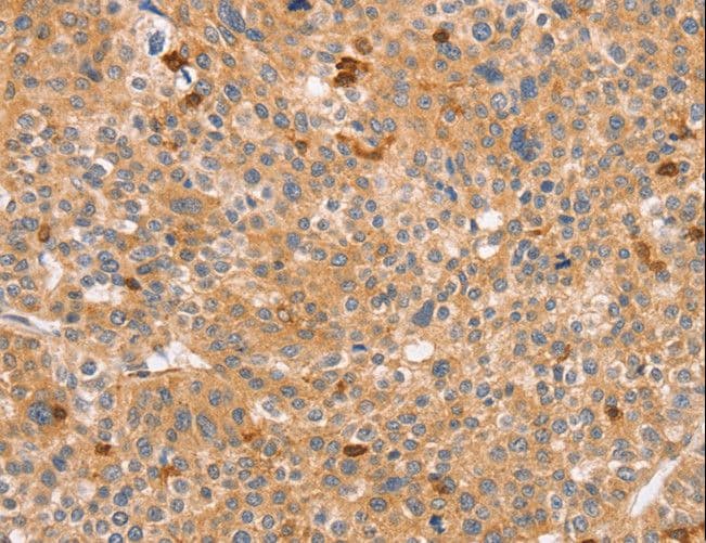 CCL16 / LEC Antibody