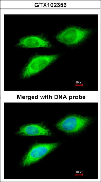BAG5 Antibody (aa1-195)