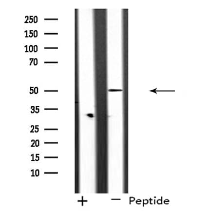 RAD51C Antibody