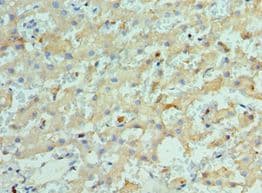 KIF2C / MCAK Antibody (aa1-190)