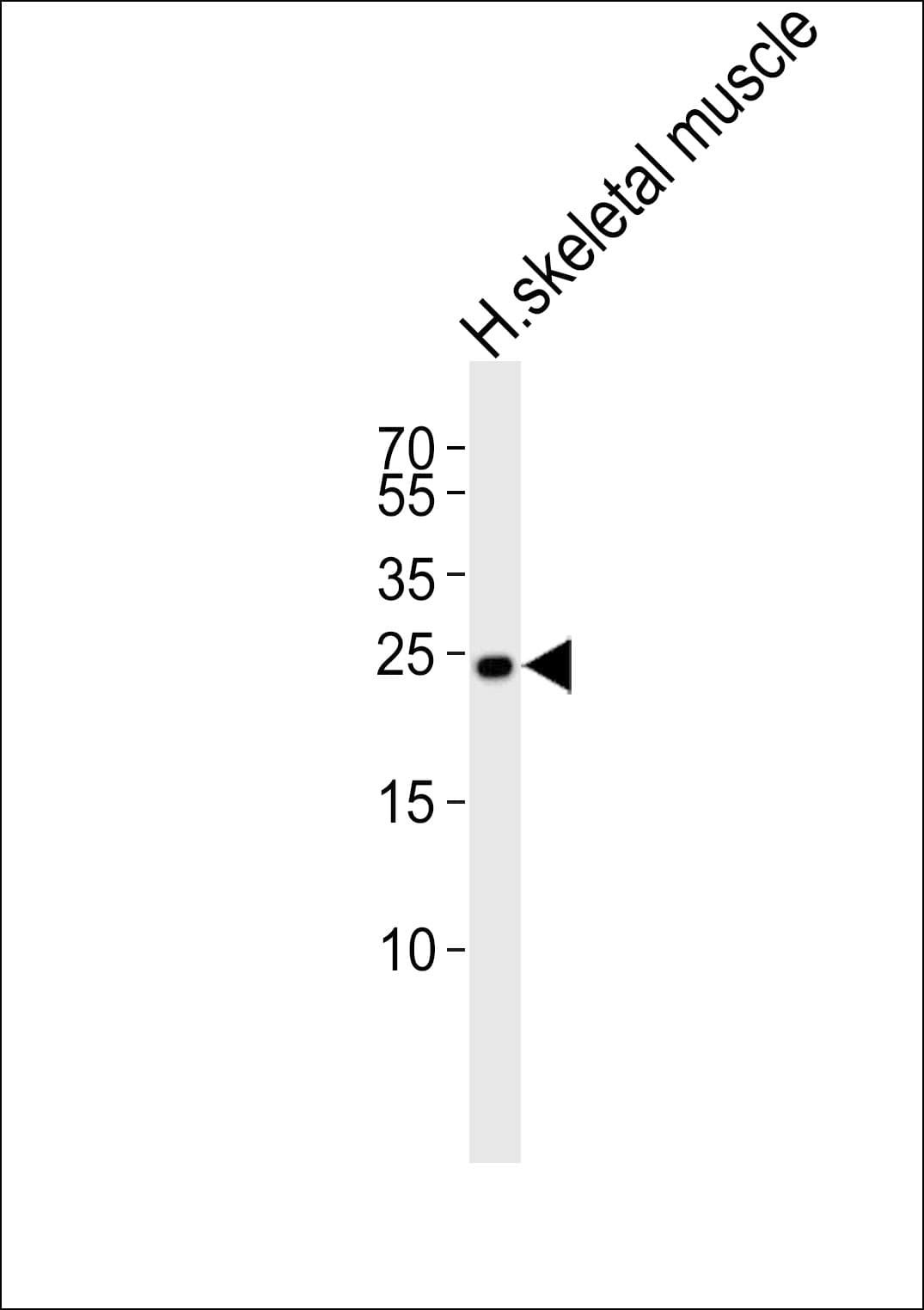 Polyclonal Rabbit anti-Human TMEM239 Antibody (aa5-38, WB)