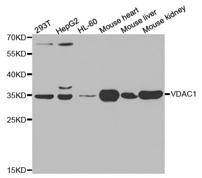VDAC1 / PORIN Antibody (aa1-283)