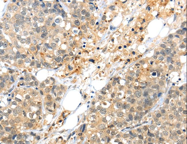 Kv10.1 / KCNG3 Antibody