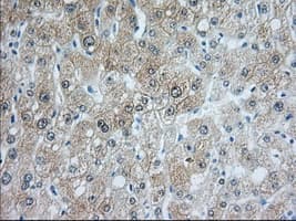 ACAT2 Antibody (clone OTI3C9)