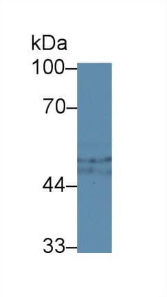SERPING1 / C1 Inhibitor Antibody (aa148-270)