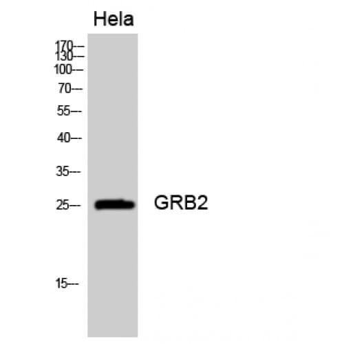 Polyclonal Rabbit anti-Human GRB2 Antibody (110-190 aa, Internal, WB)