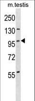 Polyclonal Rabbit anti-Human STK11IP Antibody (aa385-411, WB)
