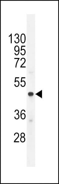 IHC-plus™ CHGA / Chromogranin A Antibody (aa376-404)